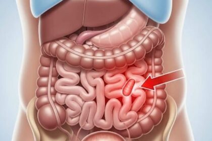 appendix pain symptoms