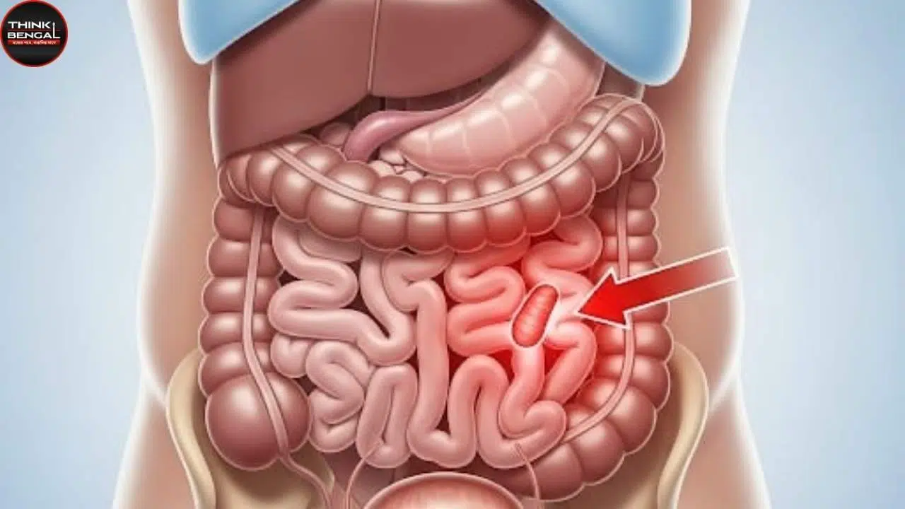 appendix pain symptoms