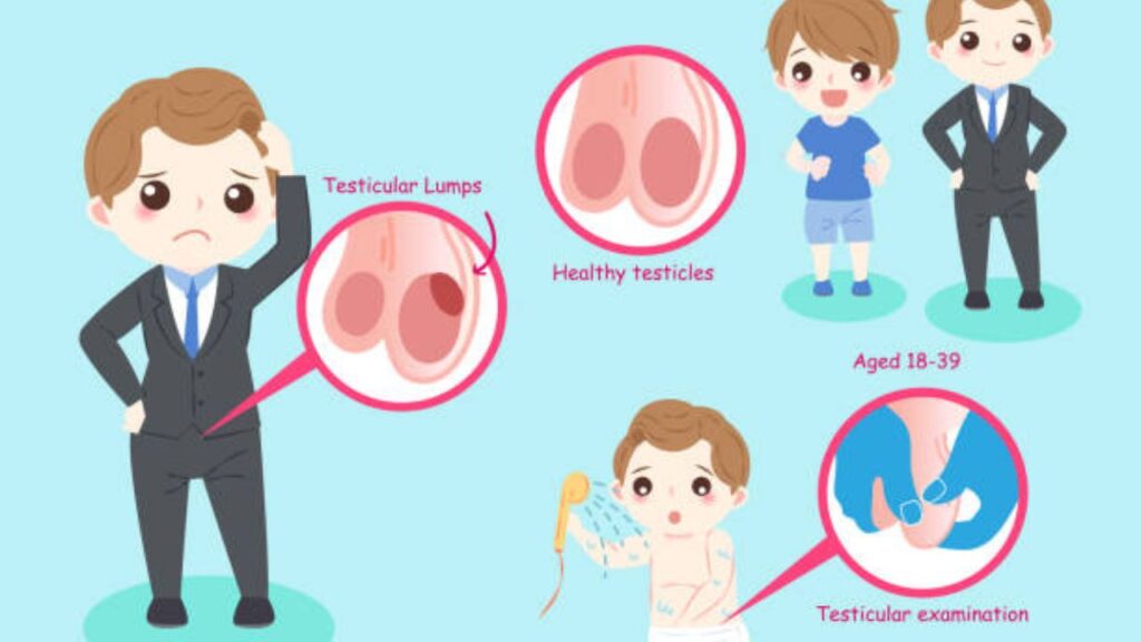 অণ্ডকোষ ছোট বড় হওয়ার কারণ