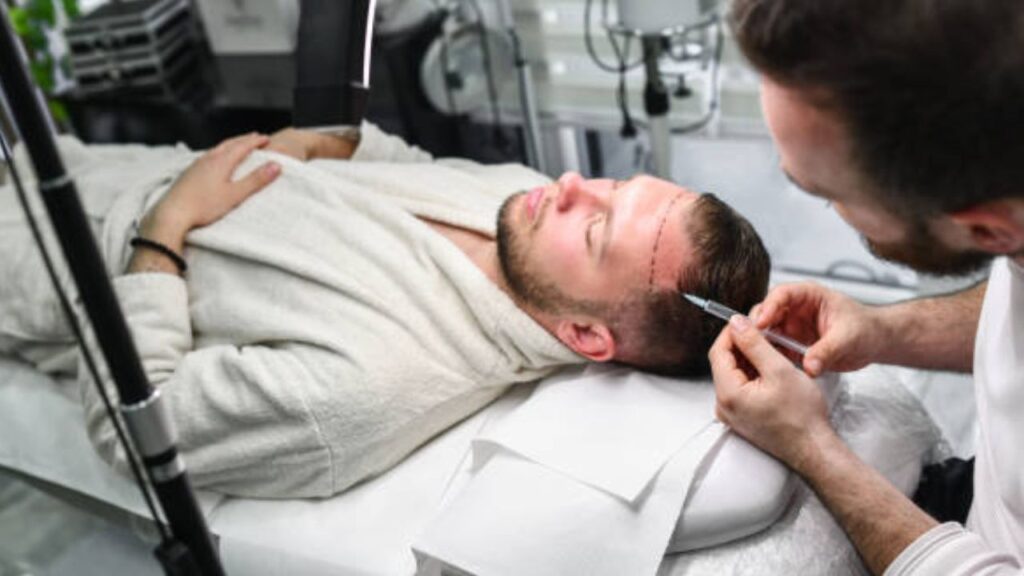 Hair Transplant Guide 2026